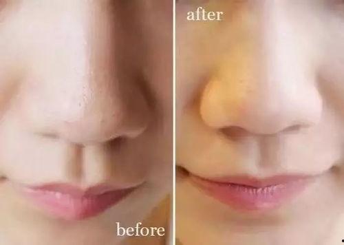 明星洗脸用棉签,棉签洗脸，揭秘明星洁面新潮流